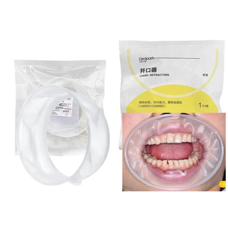 Teeth Whitening Clinic - 20 Peças Dentpark O-Shape Abridor Bucal