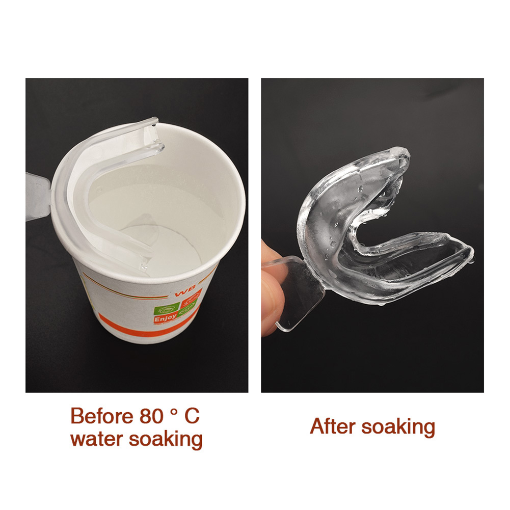 Protetor Bucal de Silicone (2- - Teeth Whitening Mouth Guard avaliação e preço