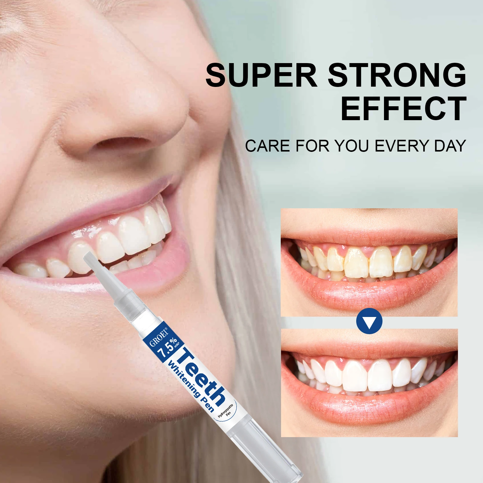 Caneta branqueadora de dente h - Teeth Whitening Gel Pen avaliação e preço