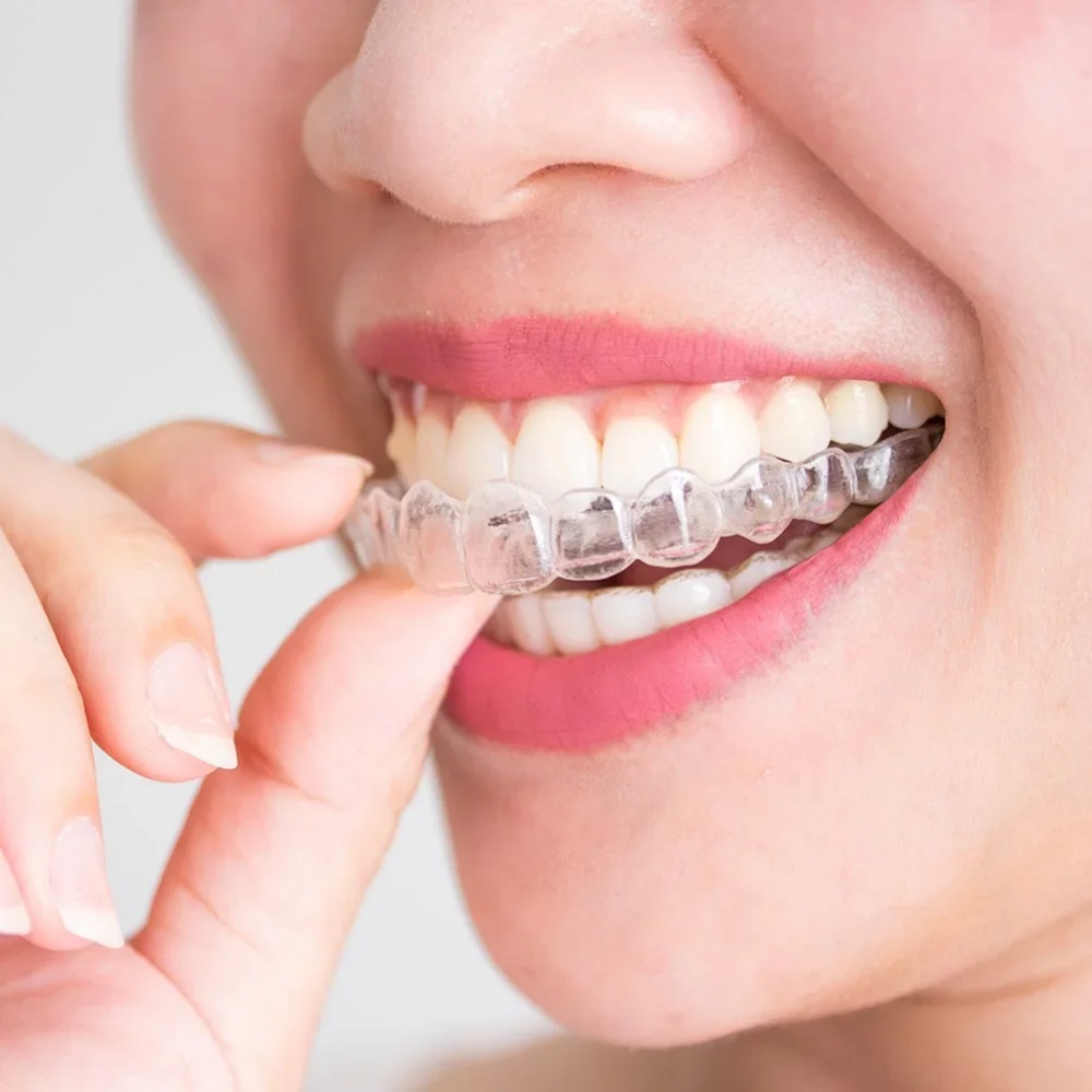 Protetor Bucal Noturno Anti Ro - Teeth Whitening Mouth Guard avaliação e preço