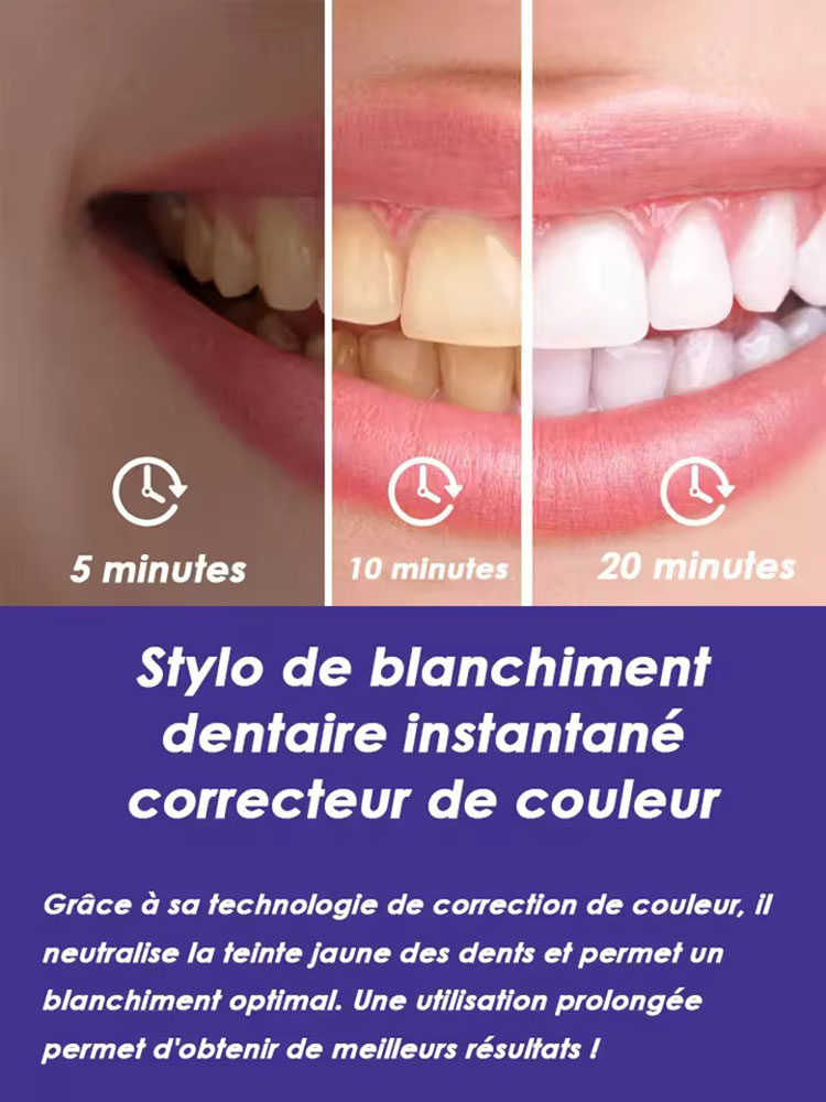 Conjunto de Canetas Clareadora - Teeth Whitening Gel Pen avaliação e preço