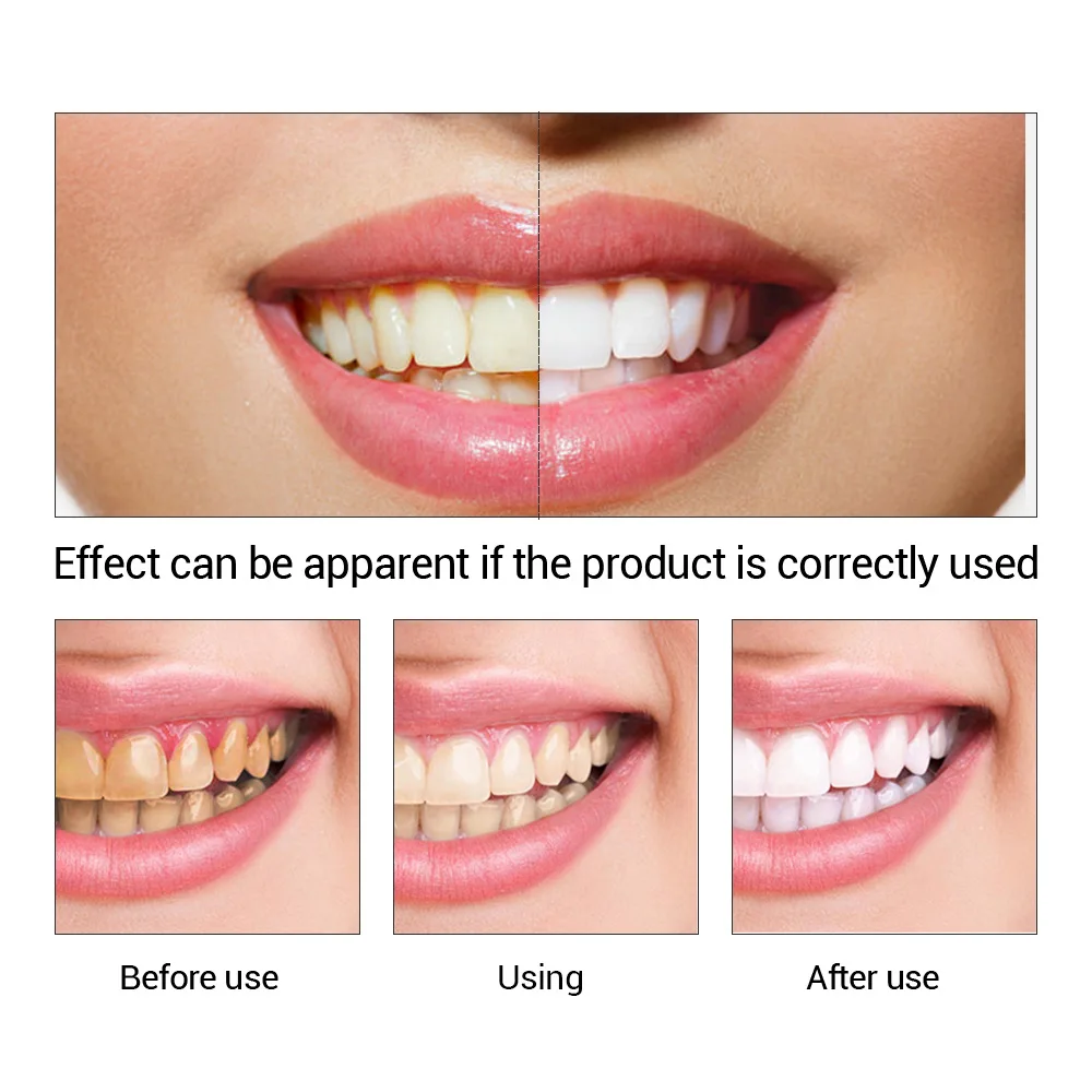 FTEENPLY Essência para claream - Teeth Whitening Bleach avaliação e preço