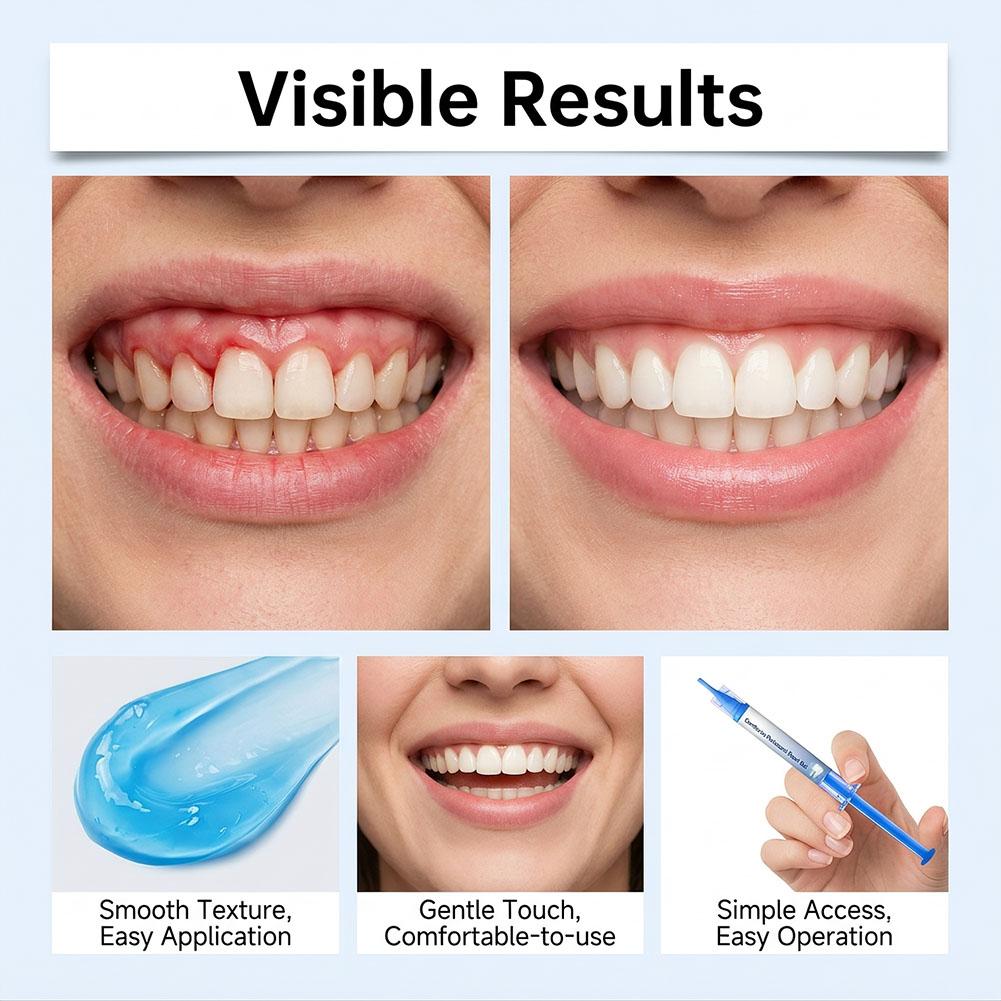 Gel Reparador Periodontal para - Teeth Whitening Gel Syringes avaliação e preço