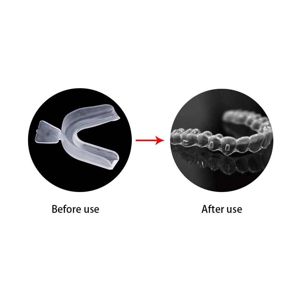 Protetor de dentes para bruxis - Teeth Whitening Mouth Guard avaliação e preço